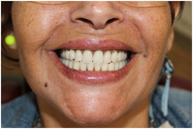 cirugia_oral2